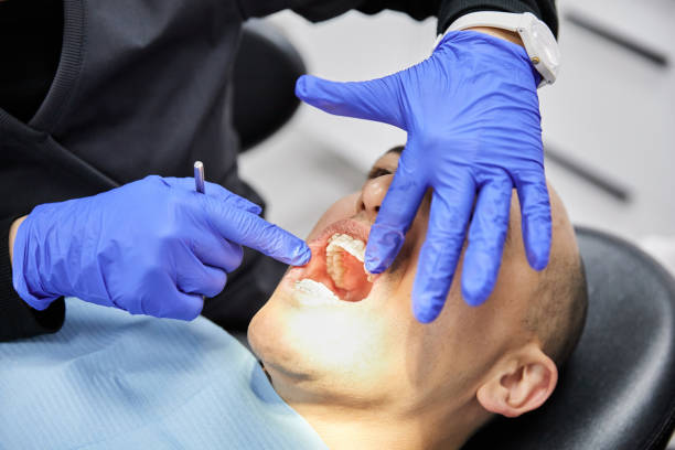 Best Dentist for Tooth Abscess  in Manheim, PA